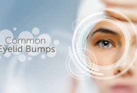 Common Eyelid Bumps