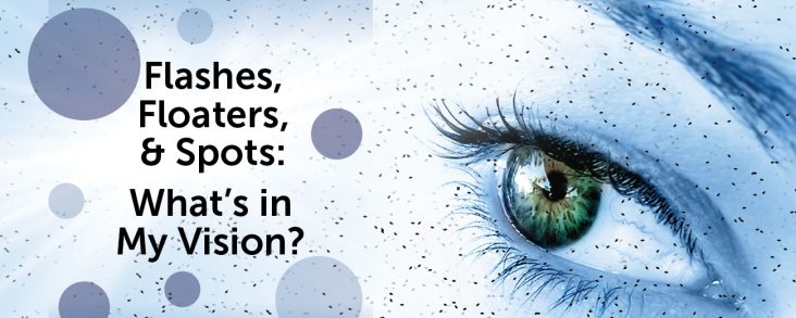 Flashes, Floaters, and Spots: What’s in my Vision?