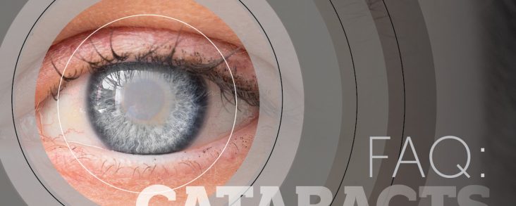 FAQ: Cataracts